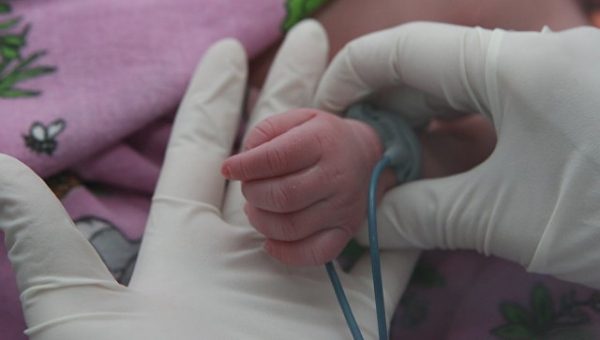 СМИ: в Индии родилась девочка с сердцем наружу