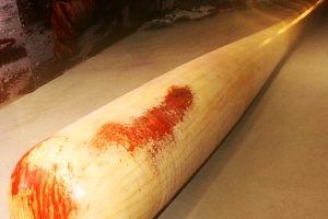 Во 2 микрорайоне пьяный мужчина забил сожительницу битой