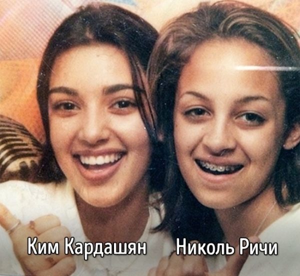 «Страшные» тайны звезд шоу-биза