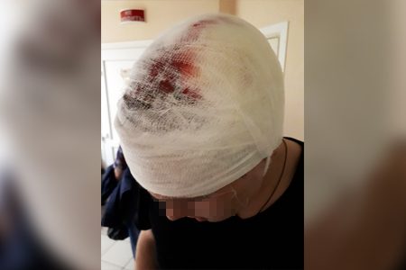 
                    Таксист сбил юношу во дворе 1-го микрорайона          