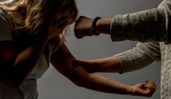 В Зеленограде задержан мужчина, подозреваемый в причинении легкого вреда здоровью 