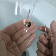 ЛОР-врачи удалили из носа пациента монету, которая пробыла там более 50 лет - ГКБ Кончаловского