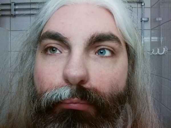 30 людей, которых генетика сделала абсолютно уникальными