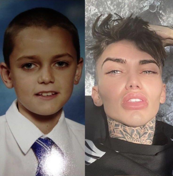 20 людей, чьё увлечение пластическими операциями перешло все разумные пределы