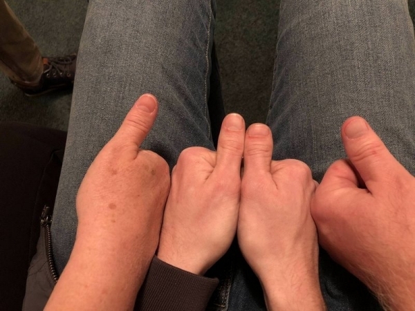 18 фотографий людей, чьё тело имеет необычные особенности