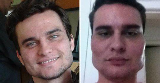 20 людей, чьё увлечение пластическими операциями перешло все разумные пределы