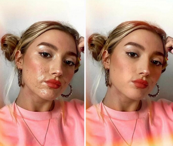 12 женщин показали себя без фильтров и фотошопа, и это лучше, чем глянцевое враньё