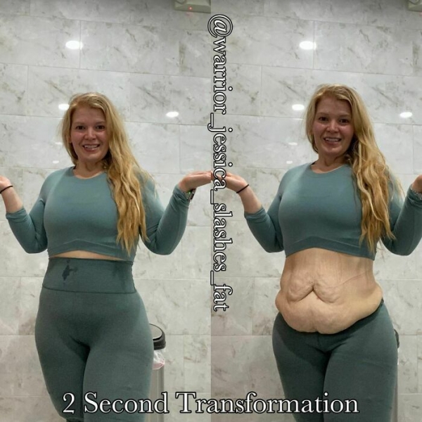Женщины показали себя без фотошопа, чтобы люди узнали, что в Инстаграме все нагло врут