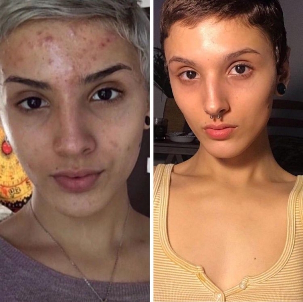 20 фото в стиле «до и после», на которых у людей меняется: вес, образ жизни и даже лицо