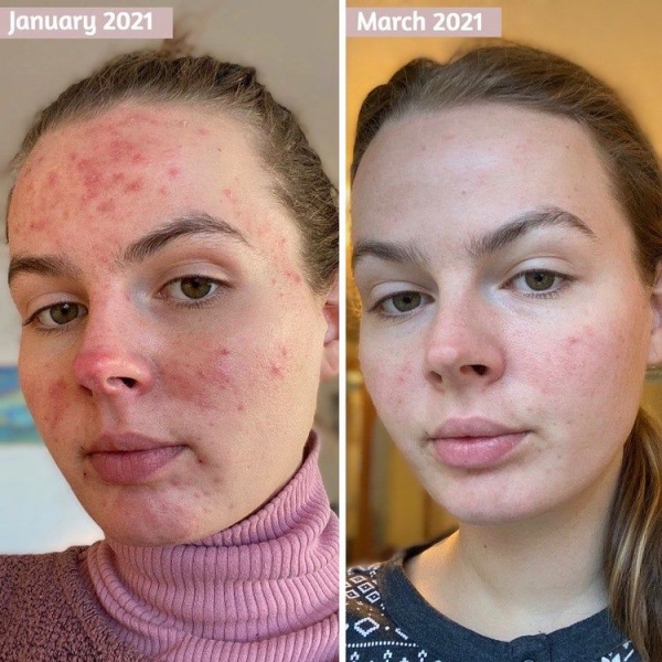 20 фото в стиле «до и после», на которых у людей меняется: вес, образ жизни и даже лицо