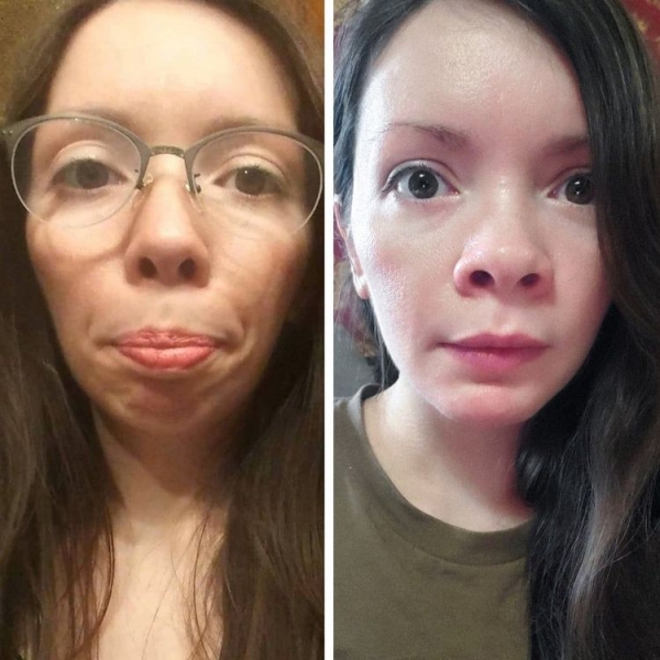 19 людей, решившихся на пластику, которых сложно узнать после операции