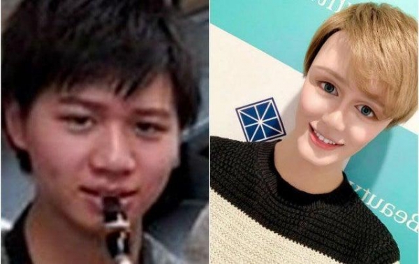 18 жертв пластических хирургов, которые на самом деле себя считают довольно привлекательными