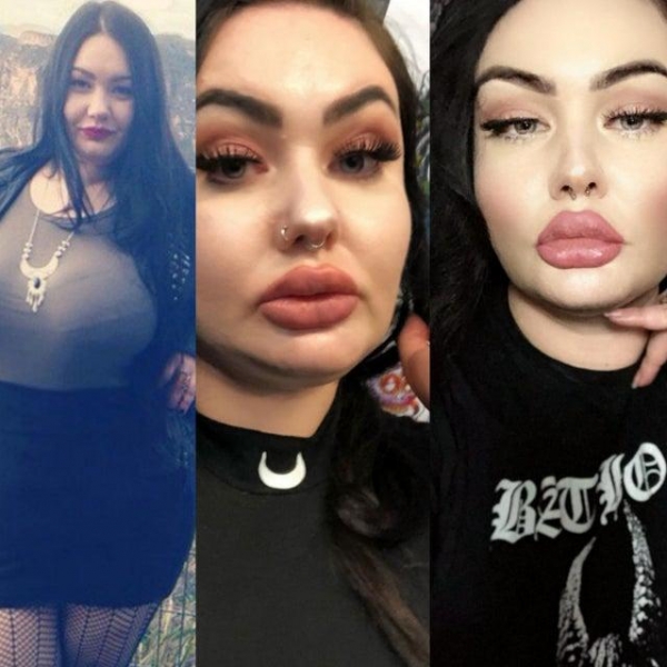 18 жертв пластических хирургов, которые на самом деле себя считают довольно привлекательными