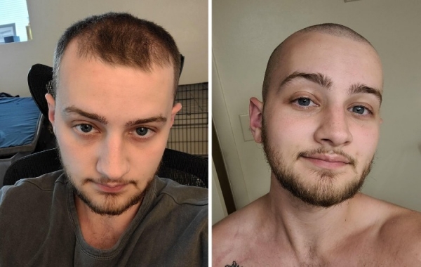 19 парней, которые убрали со своей головы лишнее и превратились в красавчиков