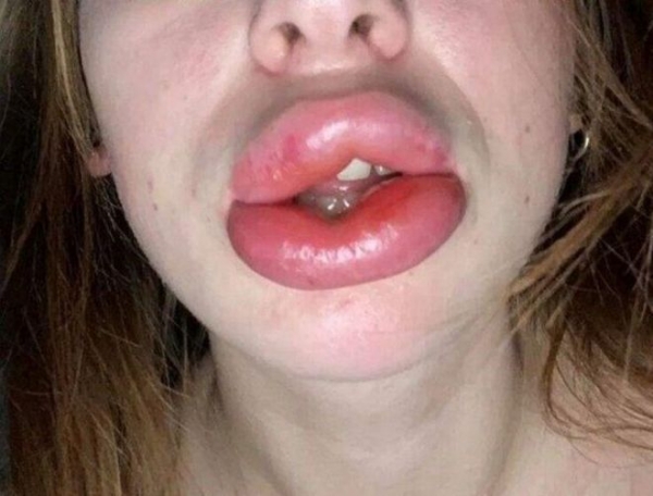 20 оттюнингованных девушек, которые хотели улучшить внешность, но получилось наоборот