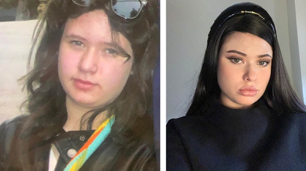 17 девушек и парней, которые из гадких утят превратились в прекрасных лебедей