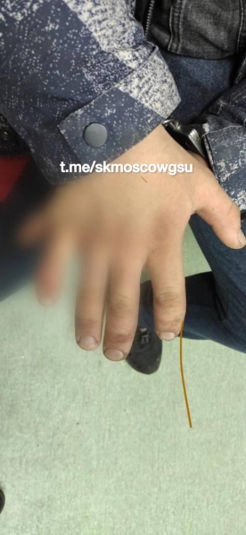 Зеленоградка опознала насильника по количеству пальцев на его руках