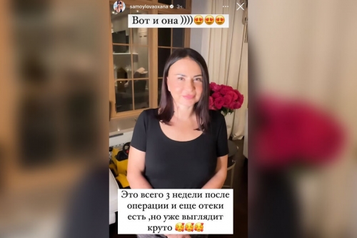 Оксана Самойлова впервые показала маму после пластической операции 