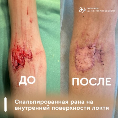 Будьте аккуратнее на дорогах! - ГКБ Кончаловского